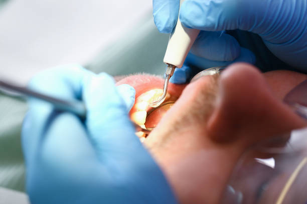 Best Emergency Dental Services for Seniors in Ashland, CA