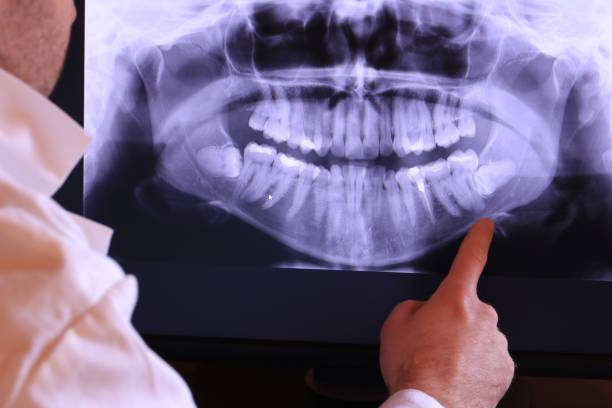 Best Broken or Cracked Tooth Emergency Dentist in Ashland, CA